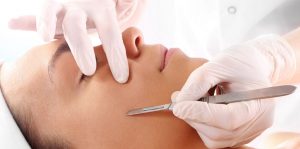 dermaplaning, női arcborotválás, penge, borotva, bőrfelszín megújítás, szőrtelenítés, rúzs és más